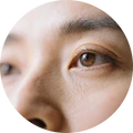 ทำเลสิก
