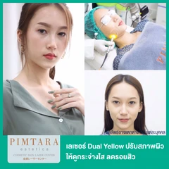 เลเซอร์ Dual Yellow ปรับสภาพผิวให้ดูกระจ่างใส ลดรอยสิว พร้อมมาส์กคอลลาเจน 1 ครั้ง