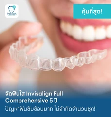 จัดฟันใส Invisalign Full Comprehensive 5 ปี