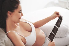 รูปภาพ Ultrasound การตั้งครรภ์