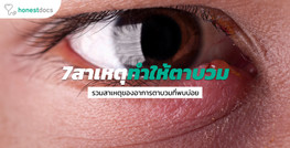 7 สาเหตุของอาการตาบวม