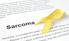 มะเร็งกล้ามเนื้อลาย ในเด็ก (Rhabdomyosarcoma)