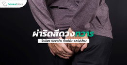 ผ่าริดสีดวงทวารแบบใหม่เจ็บน้อย ปลอดภัย ฟื้นตัวไว และไม่เสี่ยง