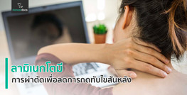การผ่าตัดกระดูกสันหลังแบบลามิเนกโตมี (Laminectomy)