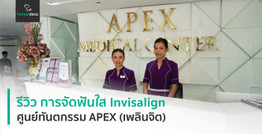 รีวิว การจัดฟันใสแบบใสด้วย Invisalign ศูนย์ทันตกรรม APEX Dental Center (สาขาเพลินจิต)