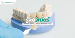 วีเนียร์...นวัตกรรมเพื่อออกแบบรอยยิ้มตามต้องการ