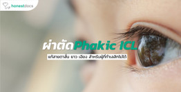 ผ่าตัดเสริมเลนส์ Phakic ICL คืออะไร อันตรายไหม?