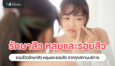 รวมรีวิวรักษาสิว หลุมสิว รอยสิว