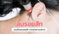 รวมรีวิวลบรอยสัก