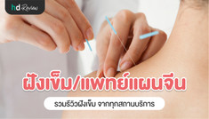 รวมรีวิวฝังเข็ม แพทย์แผนจีน