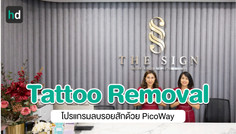 รีวิว PicoWay Tattoo Removal ลบรอยสักที่เดอะไซน์ คลินิก (The Sign Clinic)