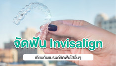จัดฟันใส ทำไมต้อง Invisalign?