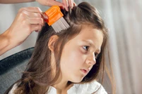 Home Remedies For Lice That Really Work วิธีการรักษาเมื่อเป็นเหาที่ได้ผลชะงักงัน