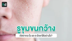 รูขุมขนกว้างเกิดจากอะไร วิธีแก้ปัญหารูขุมขนกว้าง และสารสำคัญชนิดใดที่ช่วยเรื่องรูขุมขนกว้าง