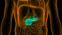 มะเร็งตับอ่อน (Pancreatic cancer)