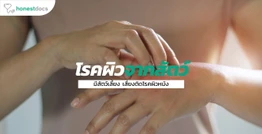 รวมอาการทางผิวหนังที่ติดต่อได้จากสัตว์เลี้ยง