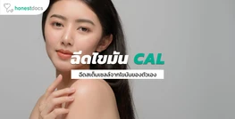 เติมเต็มใบหน้าและหน้าอกด้วยสเต็มเซลล์จากไขมัน (CAL)