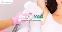 กำจัดขนด้วยเลเซอร์ Gentle YAG ดีอย่างไร?