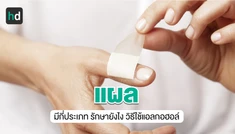 บาดแผลมีกี่แบบ มีวิธีปฐมพยาบาลอย่างไรเมื่อเกิดแผล