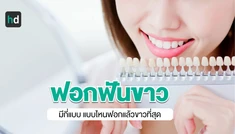 ฟอกฟันขาวมีกี่แบบ จุดเด่นแต่ละแบบ ราคา ทำแบบไหนได้ผลที่สุด