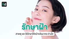 ฝ้า และสารพัดวิธีรักษาที่คุณสามารถเลือกได้
