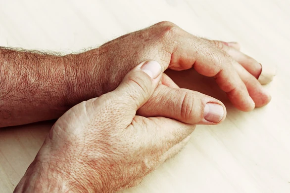 Rheumatoid Arthritis - สาเหตุ อาการ การรักษา ป้องกัน