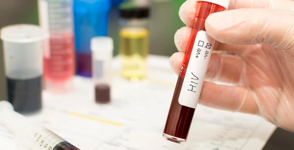 HIV / AIDS - สาเหตุ อาการ การรักษา ป้องกัน
