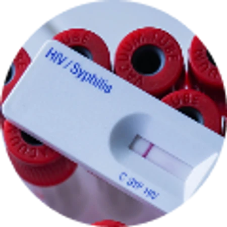 ตรวจเชื้อ HIV