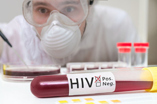 โรคเอดส์ ประวัติ ความเป็นมาของโรค HIV