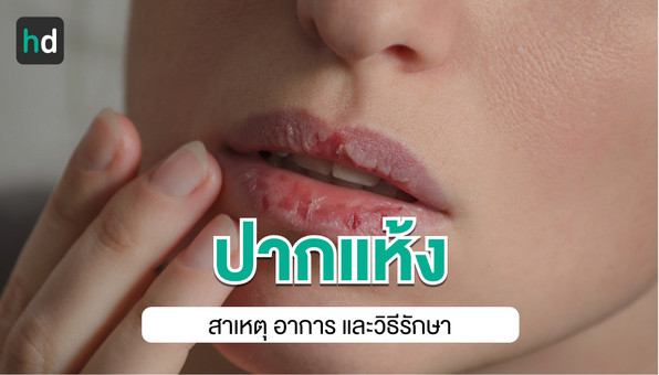 ปากแห้ง สาเหตุ อาการ วิธีรักษาป้องกันและการดูแลตนเองเมื่อปากแห้ง