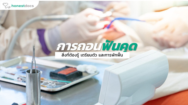 ผ่าฟันคุด เป็นอย่างไร? คู่มือการผ่าฟันคุดที่ครบถ้วนที่สุด