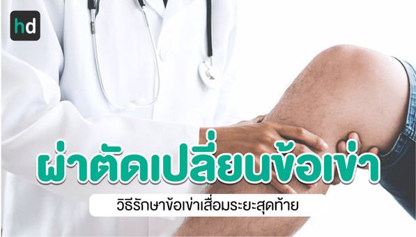 ผ่าตัดเปลี่ยนข้อเข่าเป็นอย่างไร? รวมทุกข้อมูลที่ควรรู้ทั้งหมด