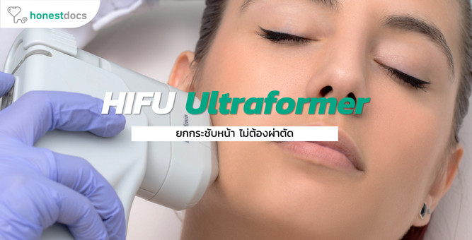Hifu Ultraformer III ยกกระชับหน้า ไม่ต้องผ่าตัด 