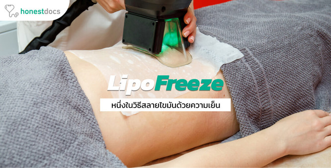 สลายไขมันด้วยความเย็น โดยเครื่อง LipoFreeze