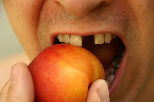 10 สาเหตุหลักของการสูญเสียฟัน