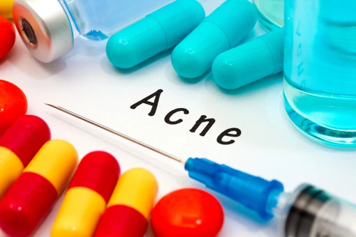 สิว (acne vulgaris) การรักษาสิวโดยใช้ยา