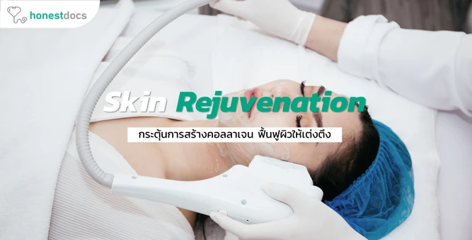 เลเซอร์ Skin Rejuvenation กระตุ้นการสร้างคอลลาเจน ฟื้นฟูผิวให้เต่งตึง