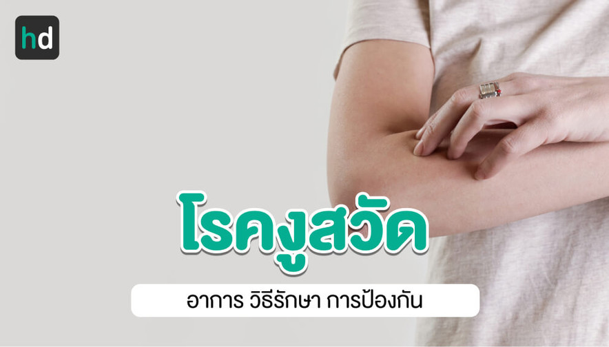 Herpes zoster Shingles DermNet