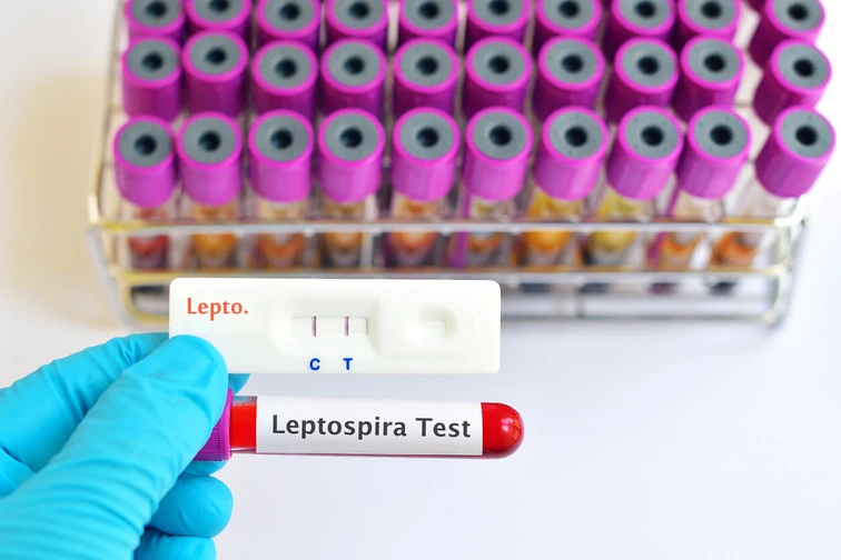 โรคฉี่หนู (Leptospirosis)