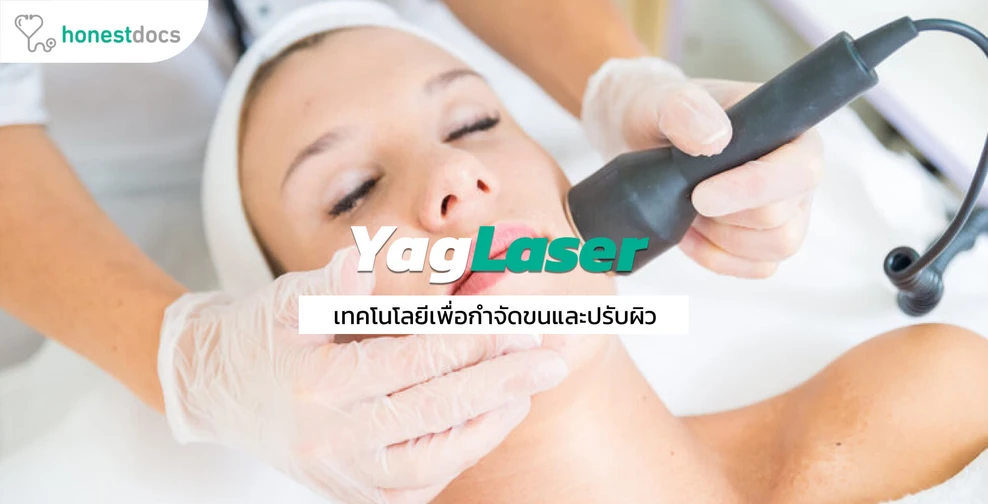Yag Laser เทคโนโลยีเพื่อการกำจัดขนและปรับผิวให้เรียบเนียน