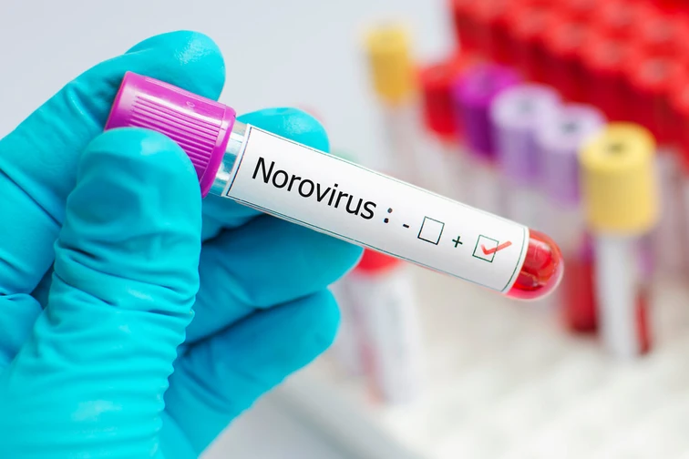 โนโรไวรัส