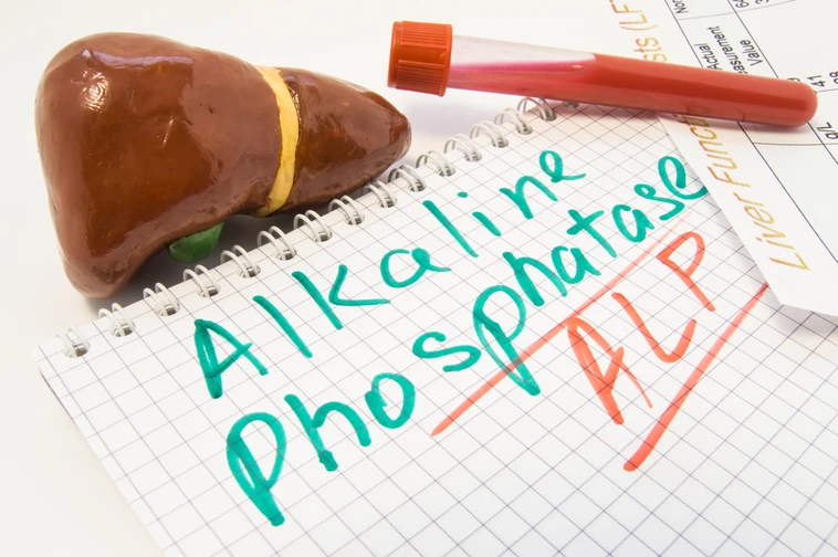 การตรวจ alkaline phosphatase คืออะไร