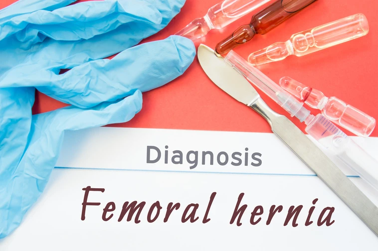 Femoral hernia คืออะไร