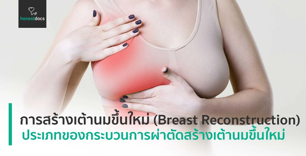 การสร้างเต้านมขึ้นใหม่ (Breast Reconstruction)