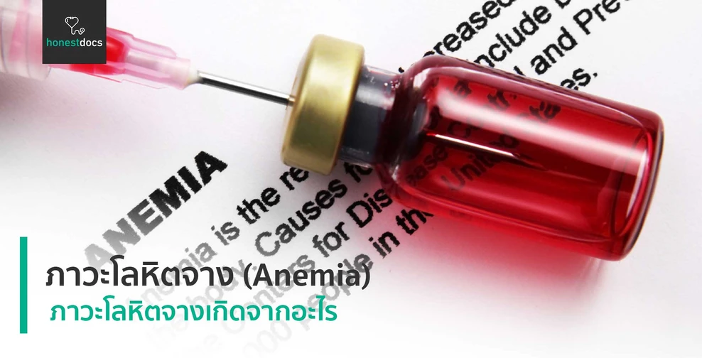 ภาวะโลหิตจาง (Anemia)