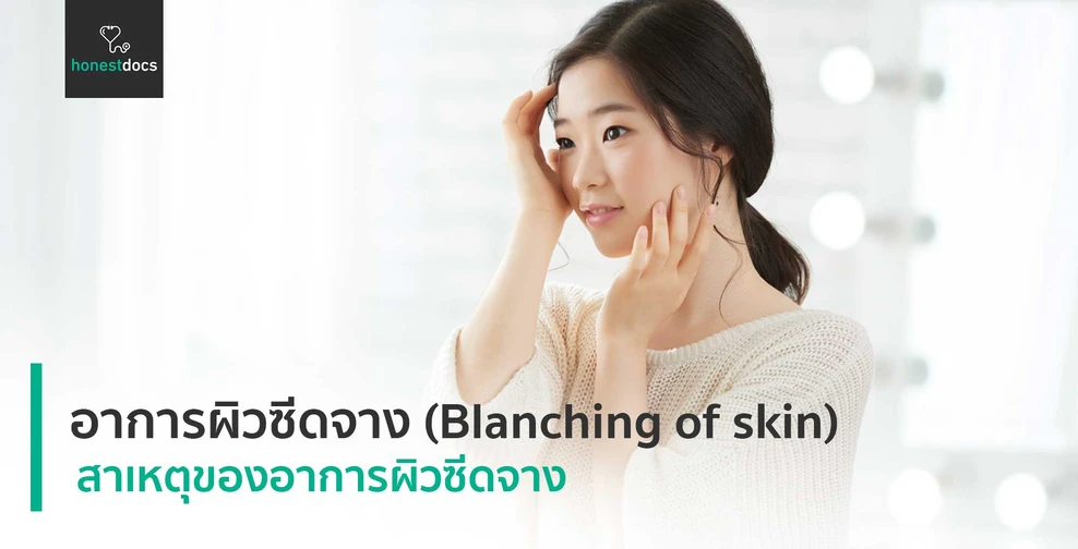 อาการผิวซีดจาง (Blanching of skin)