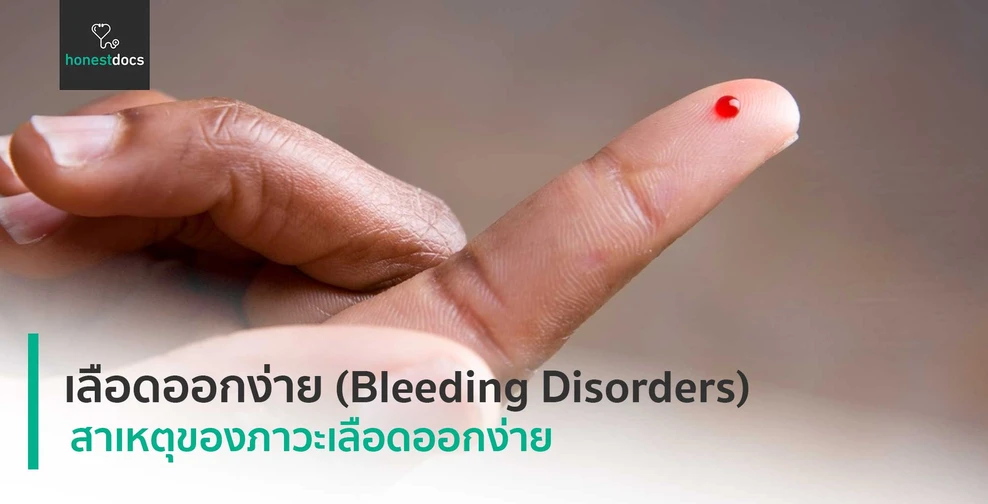 เลือดออกง่าย (Bleeding Disorders)