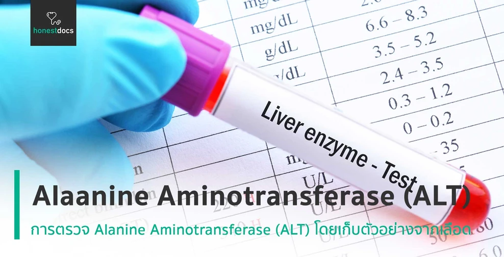 Alanine Aminotransferase (ALT)