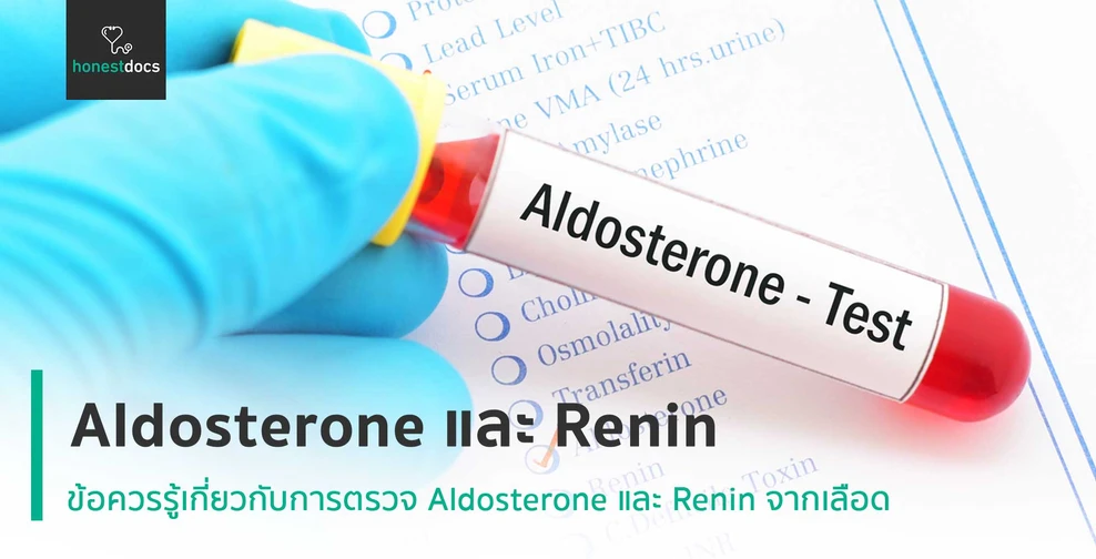 Aldosterone และ Renin