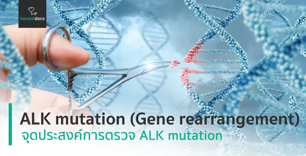 ALK mutation (Gene rearrangement)